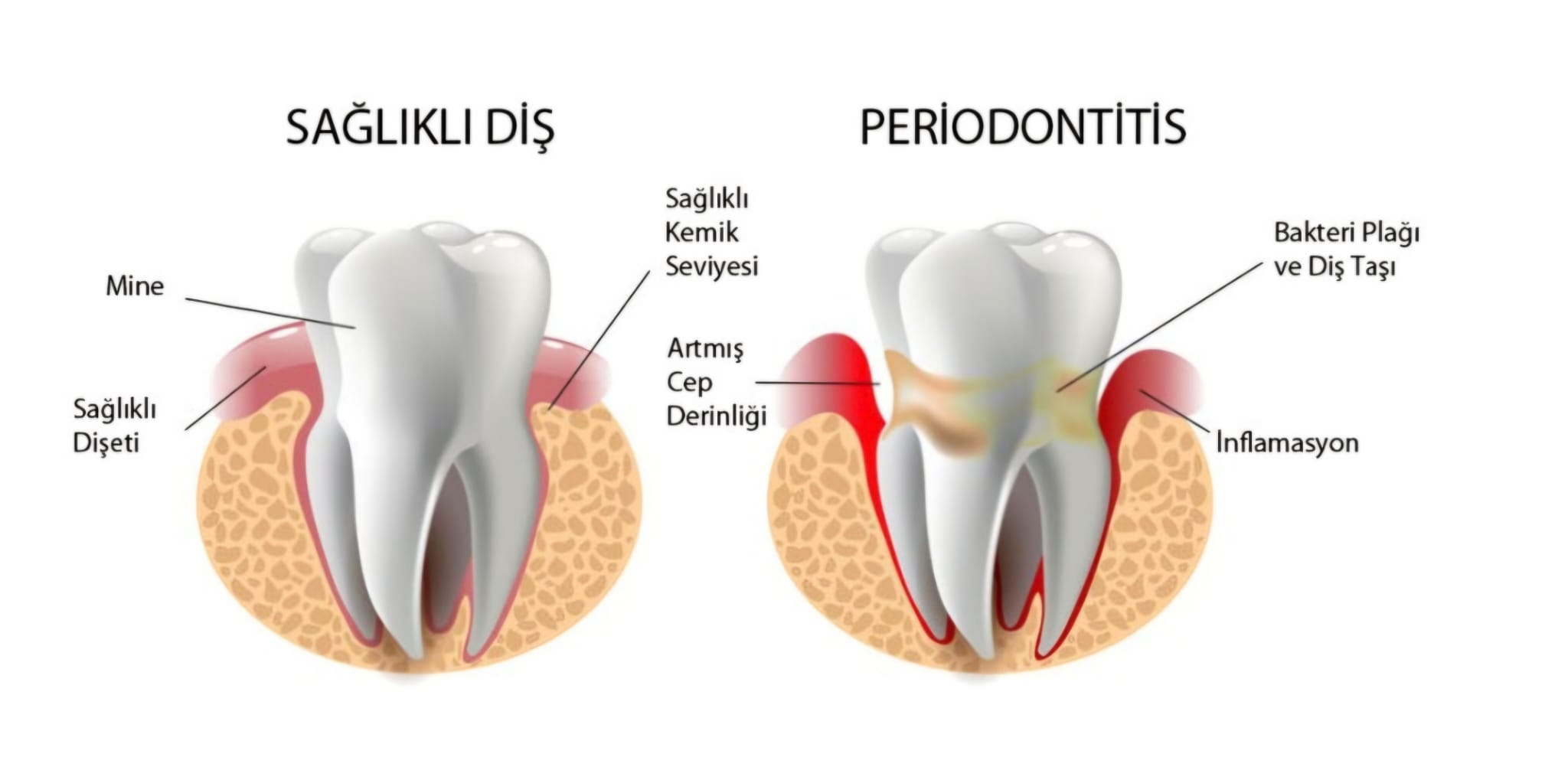 Periodontoloji
